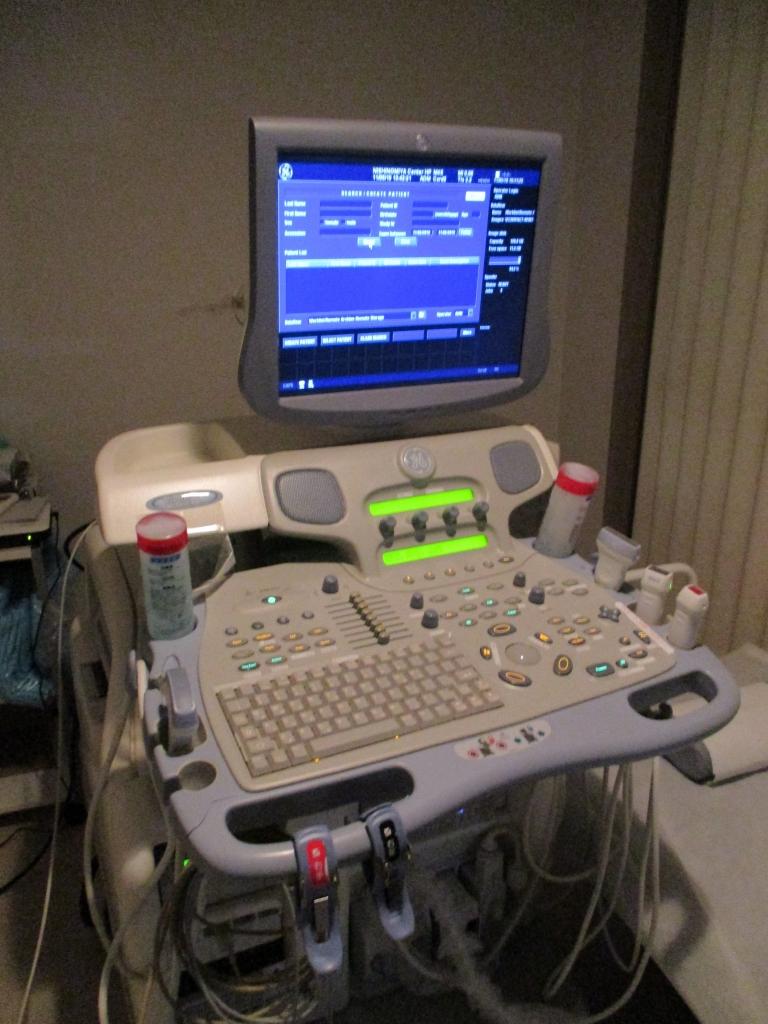 s-心臓超音波診断装置