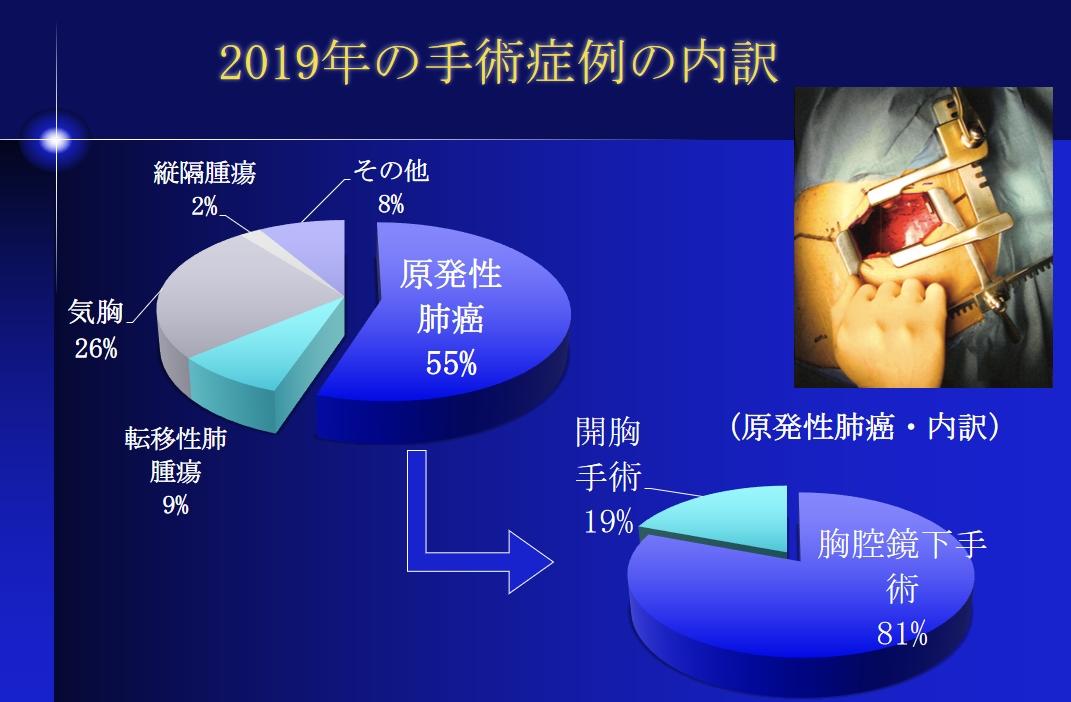 R2.呼吸器外科_2019手術症例の内訳.JPG